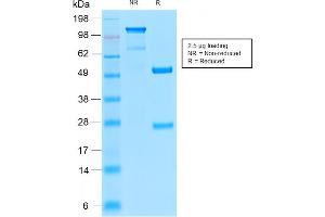 SDS-PAGE Analysis of Purified Insulin Receptor Rabbit Recombinant Monoclonal Antibody (INSR/2277R).