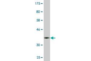 Western Blot detection against Immunogen (36. (DBF4B/DRF1 Antikörper  (AA 201-299))