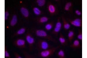 Immunofluorescence staining of methanol-fixed Hela cells using MEF2A(Phospho-Thr312) Antibody. (MEF2A Antikörper  (pThr312))