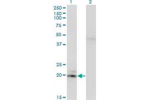 Western Blot analysis of IFNA2 expression in transfected 293T cell line by IFNA2 monoclonal antibody. (IFNA2 Antikörper  (AA 24-188))