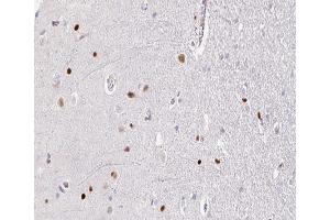 ABIN6266664 at 1/100 staining human brain tissue sections by IHC-P. (TOP2B Antikörper  (N-Term))