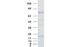 Western Blotting (WB) image for Galactosidase, beta 1 (GLB1) (Transcript Variant 1) protein (Myc-DYKDDDDK Tag) (ABIN2715243)