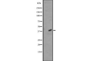 Western blot analysis of CCRK expression in RPMI-8226 cell lysate ;;,The lane on the left is treated with the antigen-specific peptide. (CCRK Antikörper  (C-Term))