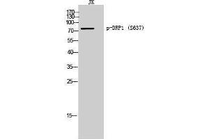 Western Blotting (WB) image for anti-Dynamin 1-Like (DNM1L) (pSer637) antibody (ABIN3173347) (Dynamin 1-Like Antikörper  (pSer637))