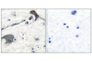 Immunohistochemistry (IHC) image for anti-RASH/RASK/RASN (N-Term) antibody (ABIN1848756) (RASH/RASK/RASN (N-Term) Antikörper)