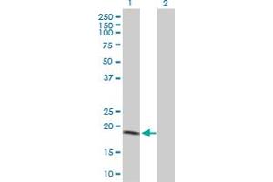 Western Blot analysis of NME1 expression in transfected 293T cell line by NME1 MaxPab polyclonal antibody. (NME1 Antikörper  (AA 1-177))