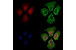 ABIN6262391 and ABIN6269042 staining Hela cells by IF/ICC. (HSPB6 Antikörper  (N-Term))