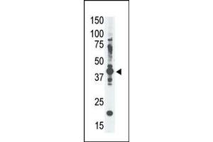 The anti-GE-A4 Pab (ABIN390108 and ABIN2840620) is used in Western blot to detect GE-A4 in  cell lysate. (MAGEA4 Antikörper  (N-Term))