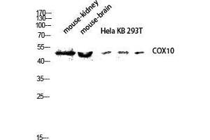 Western Blot (WB) analysis of Mouse Kidney Mouse Brain HeLa KB 293T lysis using COX10 antibody. (COX10 Antikörper  (Internal Region))