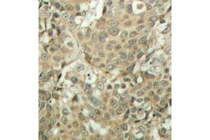 Immunohistochemistry (IHC) image for anti-Cofilin 1 (CFL1) (pSer3) antibody (ABIN3019729) (Cofilin Antikörper  (pSer3))