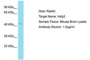 Image no. 1 for anti-Heat Shock Transcription Factor, Y Linked 2 (HSFY2) (AA 227-276) antibody (ABIN6750277) (HSFY2 Antikörper  (AA 227-276))