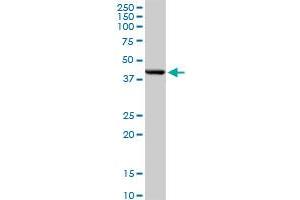 DNMT3L MaxPab rabbit polyclonal antibody. (DNMT3L Antikörper  (AA 1-386))