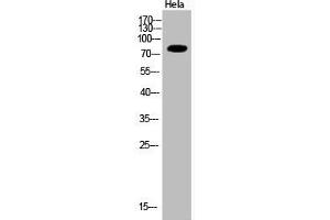 Western Blot analysis of Hela cells using Acetyl-Ub (K33) Polyclonal Antibody (UBA52/RPS27A/UBB/UBC (acLys33) Antikörper)