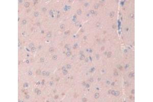 Figure. (NOG Antikörper  (AA 28-144))