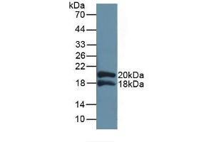 Detection of Recombinant IL1RAP, Human using Polyclonal Antibody to Interleukin 1 Receptor Accessory Protein (IL1RAP) (IL1RAP Antikörper  (AA 420-558))