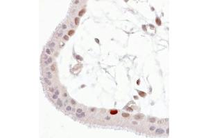 Immunohistochemistry staining of Wild-type p53 expressed in human trophoblast (paraffin-embedded sections). (p53 Antikörper  (pSer392))