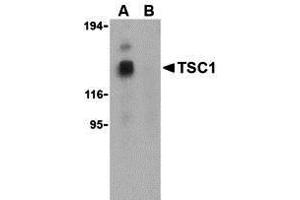 Western Blotting (WB) image for anti-Tuberous Sclerosis 1 (TSC1) (Middle Region) antibody (ABIN1031146) (TSC1 Antikörper  (Middle Region))