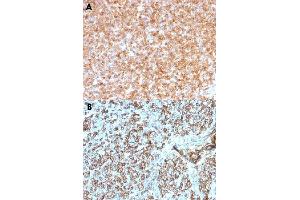 Immunohistochemical staining (Formalin-fixed paraffin-embedded sections) of human tonsil with HLA-DP/HLA-DQ/HLA-DR monoclonal antibody, clone CR3/43 . (HLA-DPB1 Antikörper)