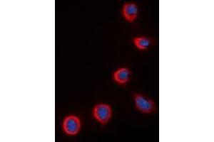 Immunofluorescent analysis of COX4-2 staining in K562 cells.
