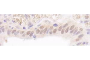 anti-Rad6 (AA 10-50) antibody