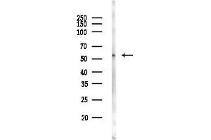 Western blot analysis of lysates from HUVEC cells, using PPP2R5B Antibody at 1/1000 dilution.