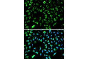 Immunofluorescence analysis of A549 cells using NME1 antibody. (NME1 Antikörper  (C-Term))