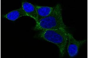 IF staining of LNCap cells using AF488 labeled ODC1 Monoclonal Antibody (ODC1/487) (Green). (ODC1 Antikörper)