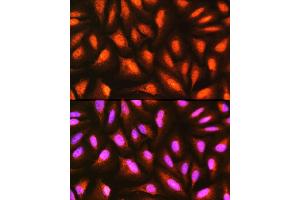 Immunofluorescence analysis of U-2 OS cells using MDFI Rabbit pAb (ABIN6128316, ABIN6143663, ABIN6143664 and ABIN6217803) at dilution of 1:100 (40x lens). (MDFI Antikörper  (AA 1-160))