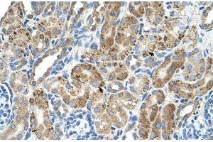 Human kidney (VMA21 Antikörper  (N-Term))