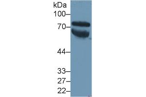 Detection of VTN in Human Serum using Polyclonal Antibody to Vitronectin (VTN) (Vitronectin Antikörper  (AA 19-468))