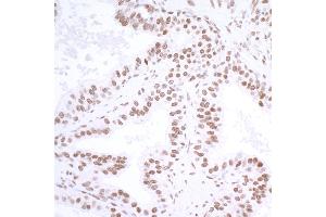 Immunohistochemistry (IHC) image for anti-Ubiquitin Specific Peptidase 7 (Herpes Virus-Associated) (USP7) (AA 1-50) antibody (ABIN7453991) (Rekombinanter USP7 Antikörper  (AA 1-50))