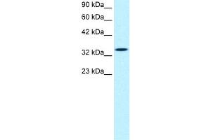 WB Suggested Anti-SMAD6 Antibody Titration:  0. (SMAD6 Antikörper  (N-Term))