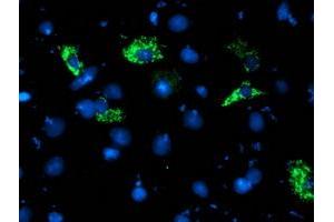 Anti-NDUFA5 mouse monoclonal antibody (ABIN2455255) immunofluorescent staining of COS7 cells transiently transfected by pCMV6-ENTRY NDUFA5 (RC201539). (NDUFA5 Antikörper  (AA 3-116))
