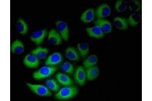 Immunofluorescent analysis of A549 cells using ABIN7161610 at dilution of 1:100 and Alexa Fluor 488-congugated AffiniPure Goat Anti-Rabbit IgG(H+L) (NINJ1 Antikörper  (AA 1-80))