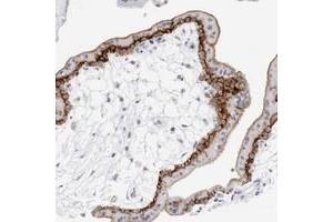 Immunohistochemical staining of human placenta with SLC19A1 polyclonal antibody  shows strong membranous positivity in trophoblastic cells at 1:200-1:500 dilution. (SLC19A1 Antikörper)