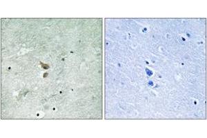 Immunohistochemistry analysis of paraffin-embedded human brain, using RIPK2 (Phospho-Ser176) Antibody. (RIPK2 Antikörper  (pSer176))