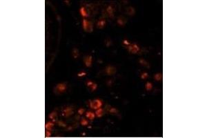 Immunofluorescence analysis of LIN28A Monoclonal Antibody with paraffin-embedded human testis tissue. (LIN28A Antikörper)