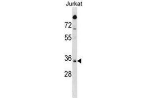 SNAPC2 Antibody (C-term) western blot analysis in Jurkat cell line lysates (35µg/lane). (SNAPC2 Antikörper  (C-Term))