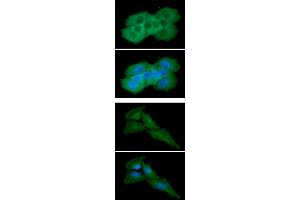 ICC/IF analysis of KRT8 in MCF7 cells line, stained with DAPI (Blue) for nucleus staining and monoclonal anti-human KRT8 antibody (1:100) with goat anti-mouse IgG-Alexa fluor 488 conjugate (Green).