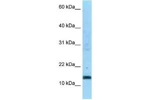 WB Suggested Anti-SDHC Antibody Titration: 1.