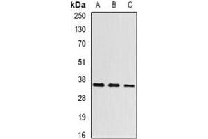 Western blot analysis of Aspartoacylase expression in Hela (A), mouse kidney (B), rat kidney (C) whole cell lysates. (ASPA Antikörper)