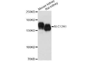Western blot analysis of extracts of various cell lines, using SLC12A1 antibody. (SLC12A1 Antikörper  (AA 50-150))