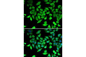Immunofluorescence analysis of U20S cell using CCAR2 antibody. (CCAR2 Antikörper)
