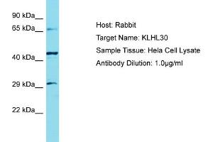 Host: Rabbit Target Name: KLHL30 Sample Tissue: Human Hela Whole Cell Antibody Dilution: 1ug/ml