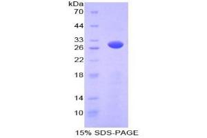 SDS-PAGE analysis of Mouse PRKAg2 Protein. (PRKAG2 Protein)