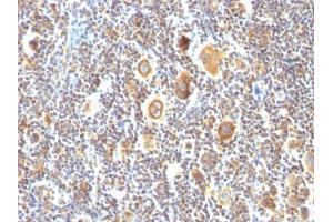 Image no. 2 for anti-B-Cell CLL/lymphoma 6 (BCL6) antibody (ABIN6175703) (BCL6 Antikörper)