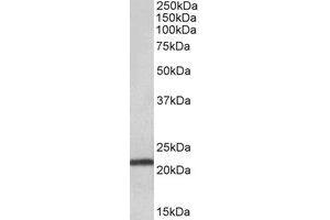 Western Blotting (WB) image for anti-Transmembrane Protein 205 (TMEM205) (Internal Region) antibody (ABIN2464767)