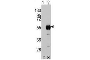 Image no. 2 for anti-Aldehyde Dehydrogenase 2 Family (Mitochondrial) (ALDH2) (AA 325-355) antibody (ABIN356918) (ALDH2 Antikörper  (AA 325-355))