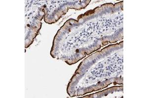 Immunohistochemical staining of human duodenum with MGAM polyclonal antibody  shows strong membranous and moderate cytoplasmic positivity in glandular cells.