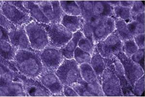 Immunofluorescent staining of Human Endothelial cells with anti-EBP50. (SLC9A3R1 Antikörper  (AA 128-249))